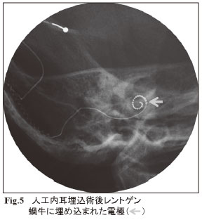 Fig.5